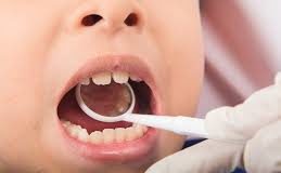 Dental Problems Your Kids Don’t Need to Have
